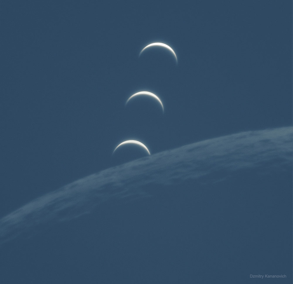 VenusSet_Kananovich_1000.jpg